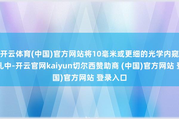 开云体育(中国)官方网站将10毫米或更细的光学内窥镜插入孔中-开云官网kaiyun切尔西赞助商 (中国)官方网站 登录入口